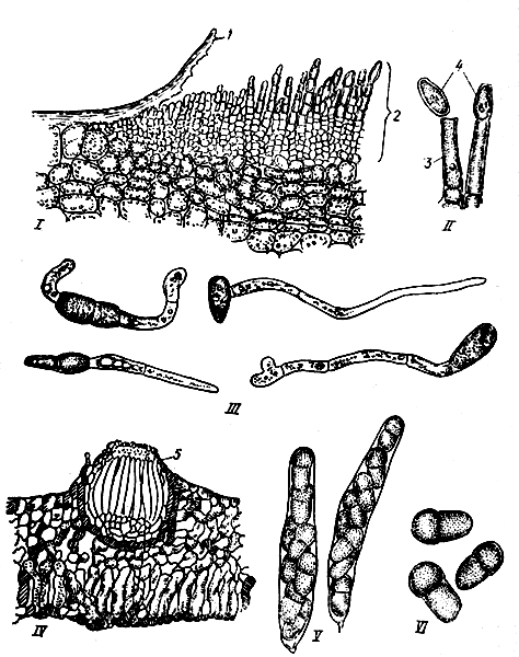 . 3.    Venturia inaequalis (Cke) Wint.   Fusicladium dendriticum (Wallr.) Fuck,  ,   : I       : 1       ; 2    ; II    : 3  ; 4   ( ); III   ; IV          ( ); 5    ,    ; V    ; VI  - ,    ( )